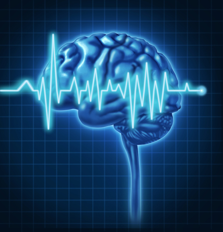 Électrophysiologie