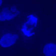 Jeu de filtres fluorescents DAPI